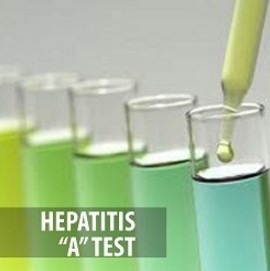 Hepatitis A Test