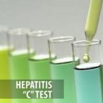 Hepatitis C Test