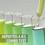 Hepatitis A,B & C Test