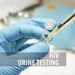 HIV Testing