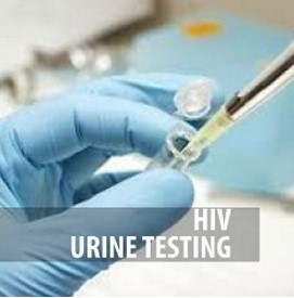 HIV Testing