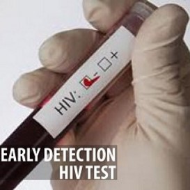 HIV DNA by PCR (Early Detection)