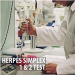 Herpes Simplex 1 & 2 Test