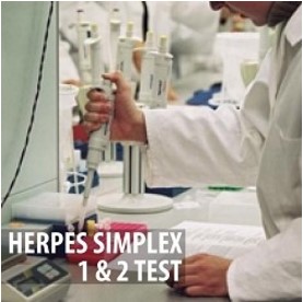 Herpes Simplex 1 & 2 Test